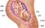胎膜早破的原因有哪些？